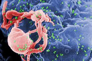 Exista un mecanism care sa blocheze virusul SIDA