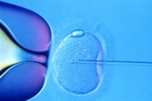 Tratamentele pentru fertilitate ameninţă structura umană, avertizează pionierul fertilizării in vitro Robert Winston
